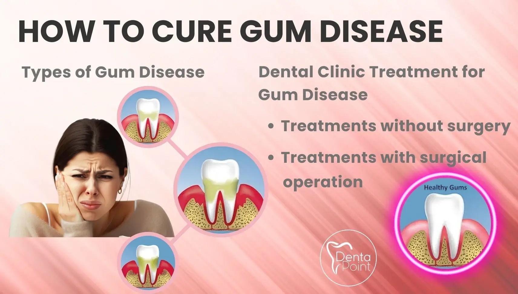 How to cure gum disease? Gum disease treatment in dental clinic